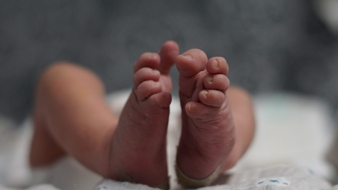 Una pareja adopta a un bebé abandonado: nació sin párpados ni nariz