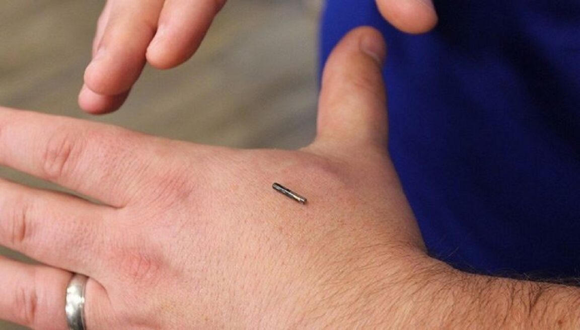 A una mujer ‘le implantaron un chip en la mano’ para poder abrir puertas y armarios sin llaves