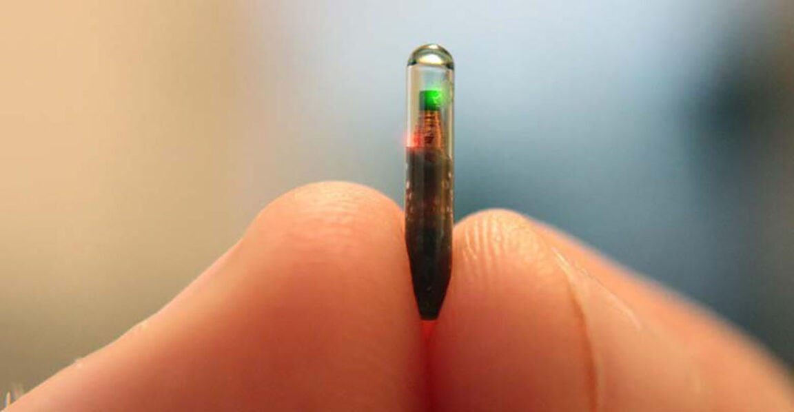 tiktoker con microchip implantado en la mano