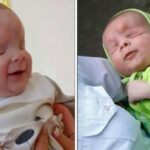 Un bebé nacido sin globos oculares busca un hogar: sólo hay otros dos como él en el mundo