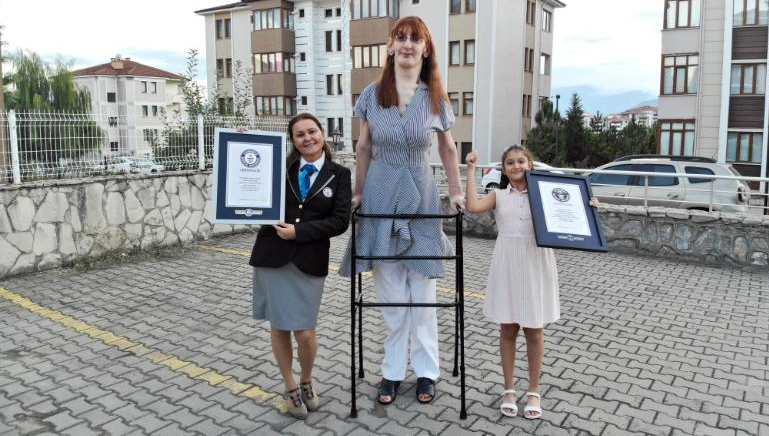 Rumeysa Gelgi, la mujer más alta del mundo