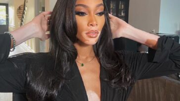 Cuál es la enfermedad que tiene la modelo Winnie Harlow