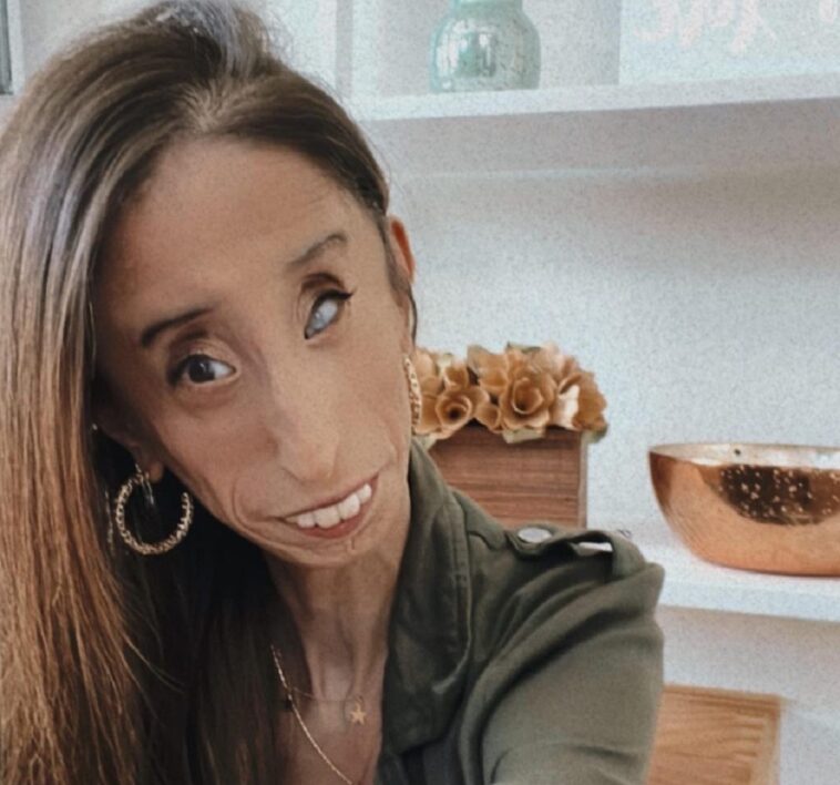 La historia de Lizzie Velásquez, la mujer más fea del mundo