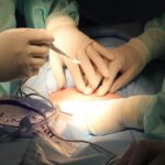 Un cirujano podría haber infectado a dos mujeres que murieron por herpes