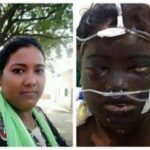 En India una madre queda con horribles cicatrices después de que su marido le arrojara ácido a la cara ‘porque consiguió un trabajo’