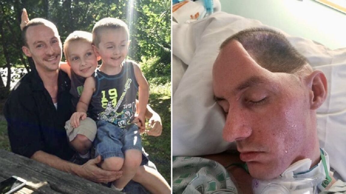 Un padre queda paralizado tras un ataque que le deja la mitad del cráneo y el cerebro «hundido»
