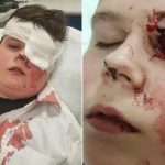 Un adolescente golpea a un joven de 15 años: le rompe las gafas y casi lo deja ciego