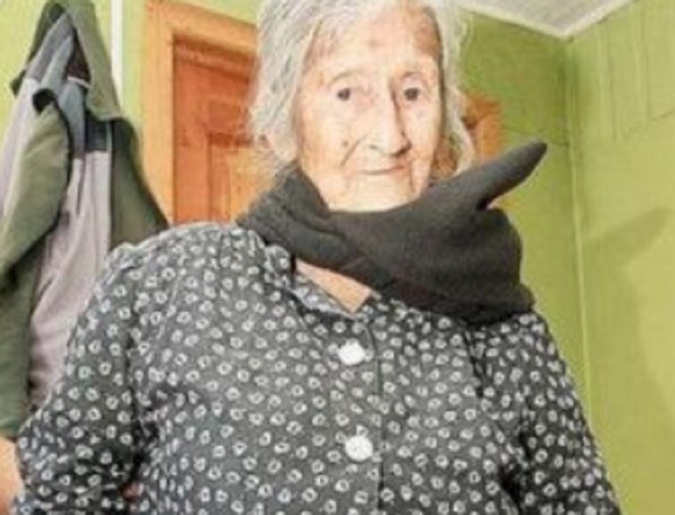 Una mujer, de 92 años, tiene en su vientre un feto momificado