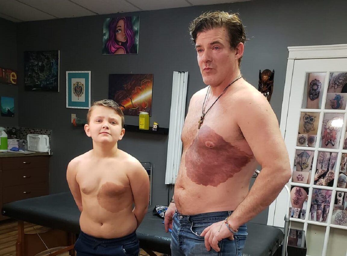 Un padre pasa 30 horas de dolor para hacerse un tatuaje que coincide con la marca de nacimiento de su hijo