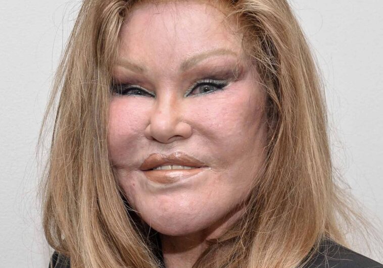 El cambio de cara de Jocelyn Wildenstein y la historia de su vida al ser acusada de «cortar» a su prometido