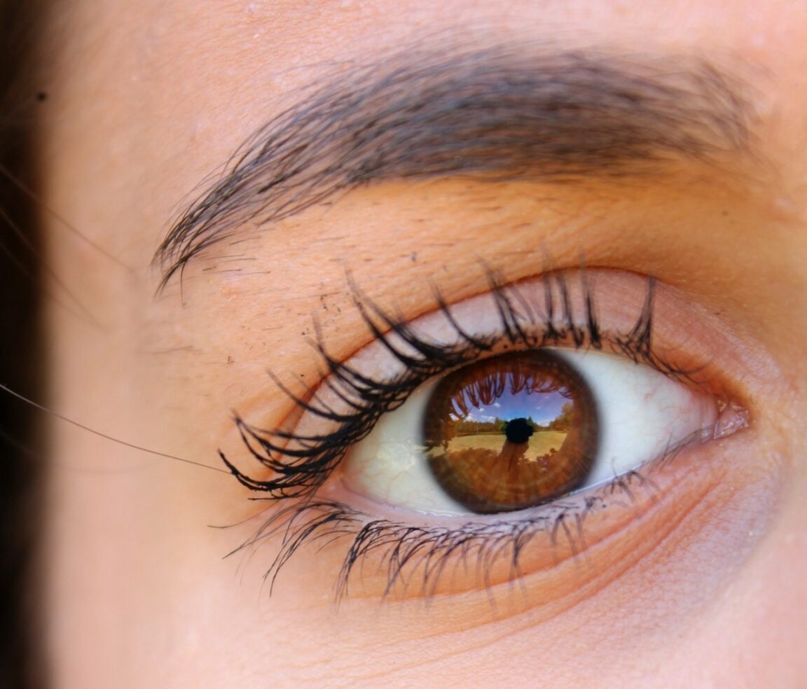El trasplante de cejas de una mujer crece tanto que tiene que recortarlas y «peinarlas»