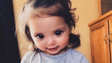 Los grandes y hermosos ojos de esta niña se deben a un raro síndrome genético