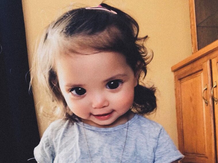 Los grandes y hermosos ojos de esta niña se deben a un raro síndrome genético