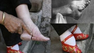 Una práctica en China de atar los pies desde hace 1.000 años, que mutila agónicamente los dedos en forma de «loto» en niñas de 4 años