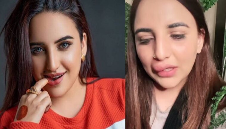 Estrella de TikTok tiene los labios torcidos tras quedarse sin dinero para terminar el tratamiento de belleza