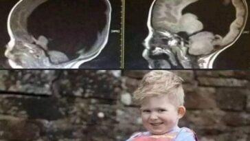Niño nació «sin» cerebro, pero ahora está sano. La madre: «Me dijeron que abortara»